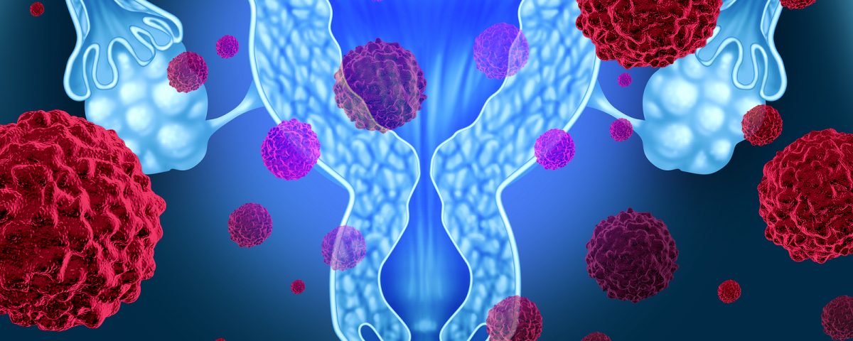 cervical polyps