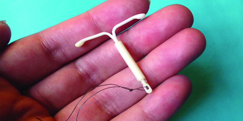 Intrauterine Device (IUD) - Bloom OBGYN